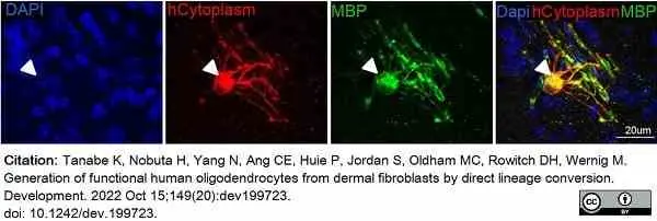 Anti MBP (aa82-87) Antibody, clone 12 gallery image 56