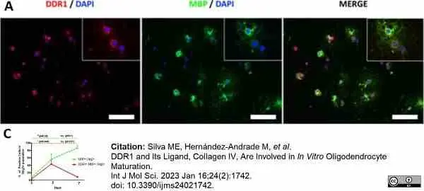 Anti MBP (aa82-87) Antibody, clone 12 gallery image 57