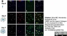 Anti MBP (aa82-87) Antibody, clone 12 gallery image 58
