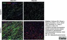 Anti MBP (aa82-87) Antibody, clone 12 gallery image 61