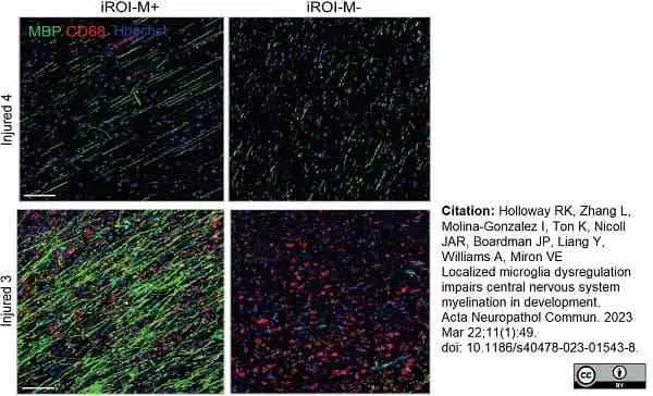 Anti MBP (aa82-87) Antibody, clone 12 gallery image 61
