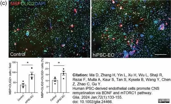 Anti MBP (aa82-87) Antibody, clone 12 gallery image 64