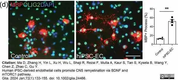 Anti MBP (aa82-87) Antibody, clone 12 gallery image 65