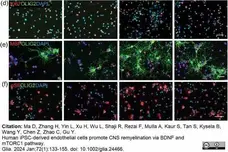 Anti MBP (aa82-87) Antibody, clone 12 gallery image 66