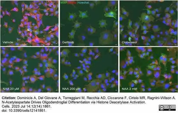 Anti MBP (aa82-87) Antibody, clone 12 gallery image 68