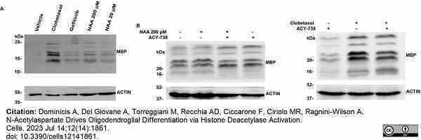 Anti MBP (aa82-87) Antibody, clone 12 gallery image 68