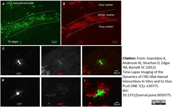 Anti MBP (aa82-87) Antibody, clone 12 gallery image 7