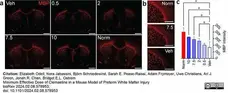 Anti MBP (aa82-87) Antibody, clone 12 gallery image 71