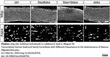 Anti MBP (aa82-87) Antibody, clone 12 gallery image 75