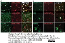 Anti MBP (aa82-87) Antibody, clone 12 gallery image 78