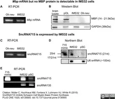 Anti MBP (aa82-87) Antibody, clone 12 gallery image 9