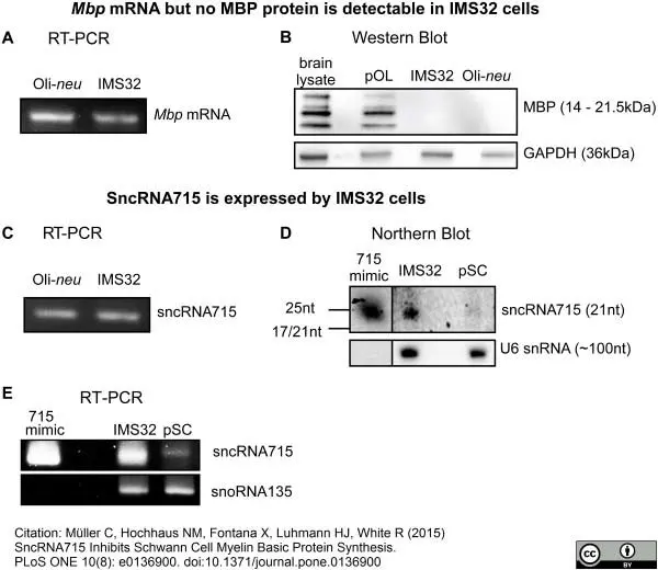 Anti MBP (aa82-87) Antibody, clone 12 gallery image 9