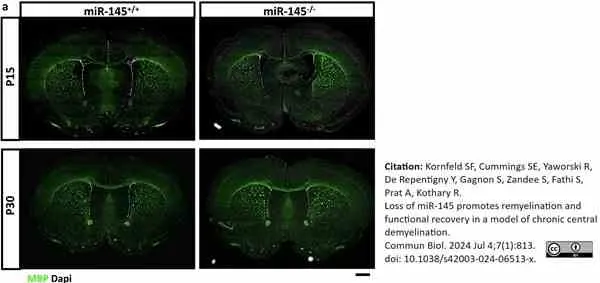 Anti MBP (aa36-50) Antibody, clone 14 gallery image 2