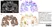 Anti Myelin Proteolipid Protein Antibody, clone plpc1 thumbnail image 10