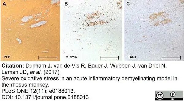 Anti Myelin Proteolipid Protein Antibody, clone plpc1 gallery image 11