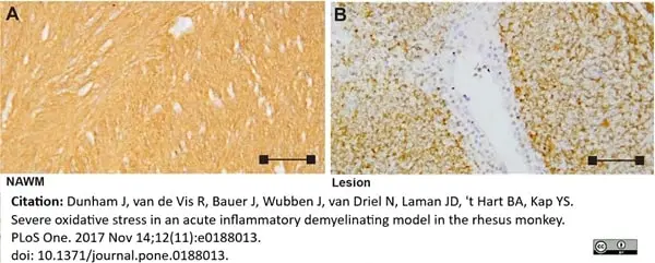 Anti Myelin Proteolipid Protein Antibody, clone plpc1 gallery image 12