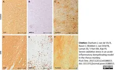 Anti Myelin Proteolipid Protein Antibody, clone plpc1 gallery image 13