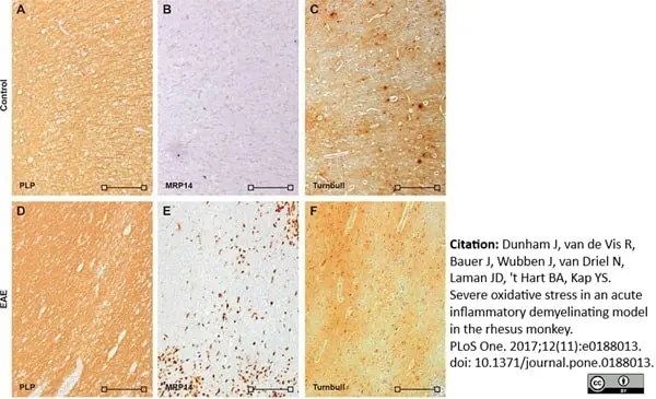 Anti Myelin Proteolipid Protein Antibody, clone plpc1 gallery image 13