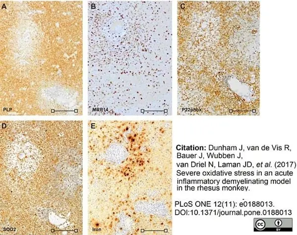 Anti Myelin Proteolipid Protein Antibody, clone plpc1 gallery image 14