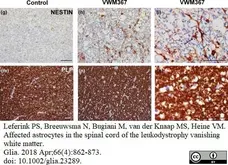 Anti Myelin Proteolipid Protein Antibody, clone plpc1 gallery image 15