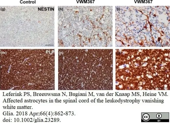 Anti Myelin Proteolipid Protein Antibody, clone plpc1 gallery image 15