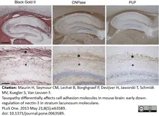 Anti Myelin Proteolipid Protein Antibody, clone plpc1 gallery image 16