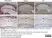 Anti Myelin Proteolipid Protein Antibody, clone plpc1 thumbnail image 16