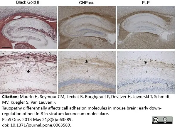 Anti Myelin Proteolipid Protein Antibody, clone plpc1 gallery image 16
