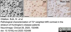 Anti Myelin Proteolipid Protein Antibody, clone plpc1 gallery image 19