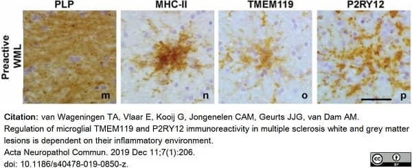 Anti Myelin Proteolipid Protein Antibody, clone plpc1 gallery image 20