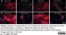 Anti Myelin Proteolipid Protein Antibody, clone plpc1 gallery image 25