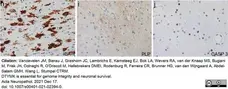 Anti Myelin Proteolipid Protein Antibody, clone plpc1 gallery image 26