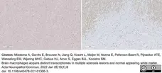Anti Myelin Proteolipid Protein Antibody, clone plpc1 gallery image 27
