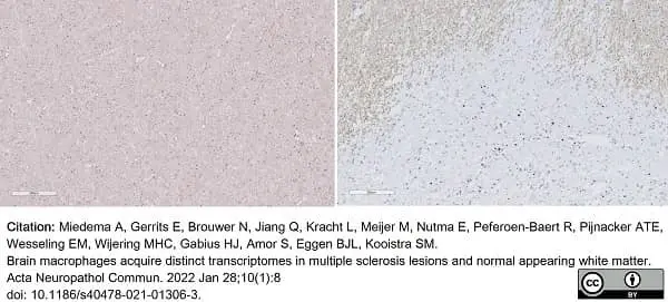 Anti Myelin Proteolipid Protein Antibody, clone plpc1 gallery image 27