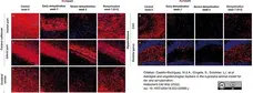 Anti Myelin Proteolipid Protein Antibody, clone plpc1 gallery image 28