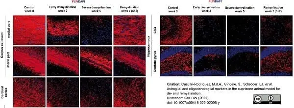 Anti Myelin Proteolipid Protein Antibody, clone plpc1 gallery image 28