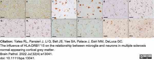 Anti Myelin Proteolipid Protein Antibody, clone plpc1 gallery image 29