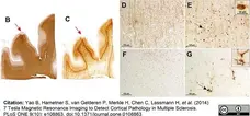 Anti Myelin Proteolipid Protein Antibody, clone plpc1 gallery image 3