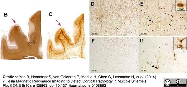 Anti Myelin Proteolipid Protein Antibody, clone plpc1 gallery image 3