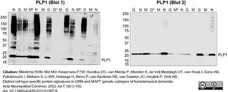 Anti Myelin Proteolipid Protein Antibody, clone plpc1 gallery image 30