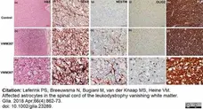 Anti Myelin Proteolipid Protein Antibody, clone plpc1 gallery image 32