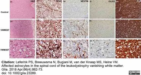 Anti Myelin Proteolipid Protein Antibody, clone plpc1 gallery image 32