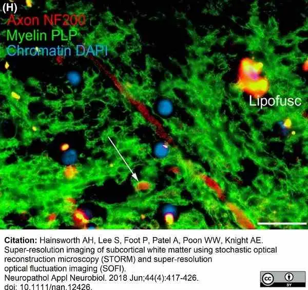 Anti Myelin Proteolipid Protein Antibody, clone plpc1 gallery image 33
