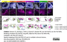 Anti Myelin Proteolipid Protein Antibody, clone plpc1 gallery image 38