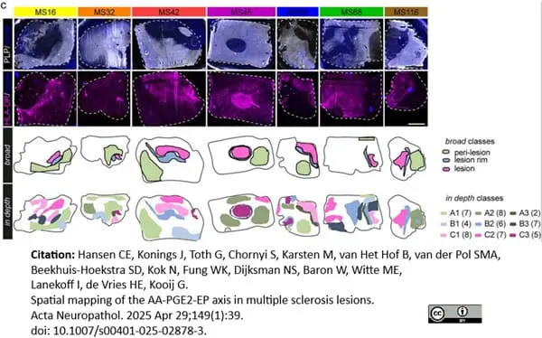 Anti Myelin Proteolipid Protein Antibody, clone plpc1 gallery image 38