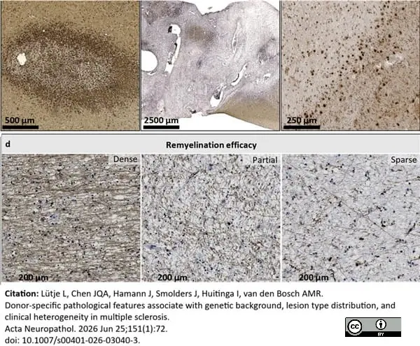 Anti Myelin Proteolipid Protein Antibody, clone plpc1 gallery image 39