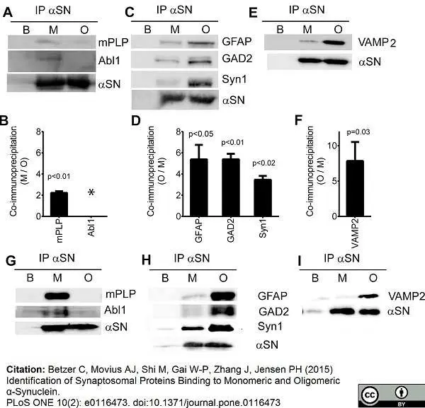 Anti Myelin Proteolipid Protein Antibody, clone plpc1 gallery image 4