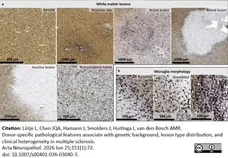 Anti Myelin Proteolipid Protein Antibody, clone plpc1 gallery image 40
