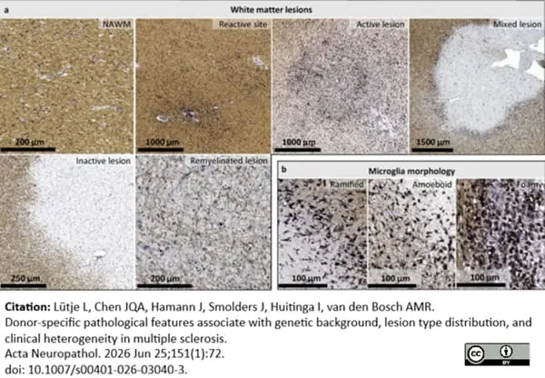 Anti Myelin Proteolipid Protein Antibody, clone plpc1 gallery image 40