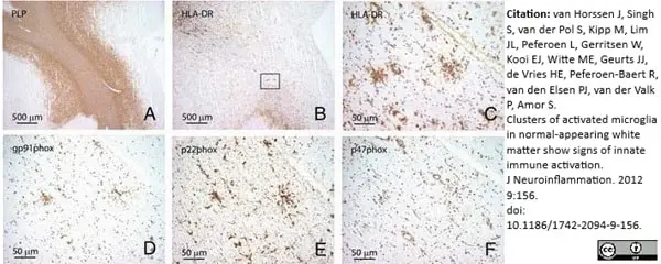 Anti Myelin Proteolipid Protein Antibody, clone plpc1 gallery image 5
